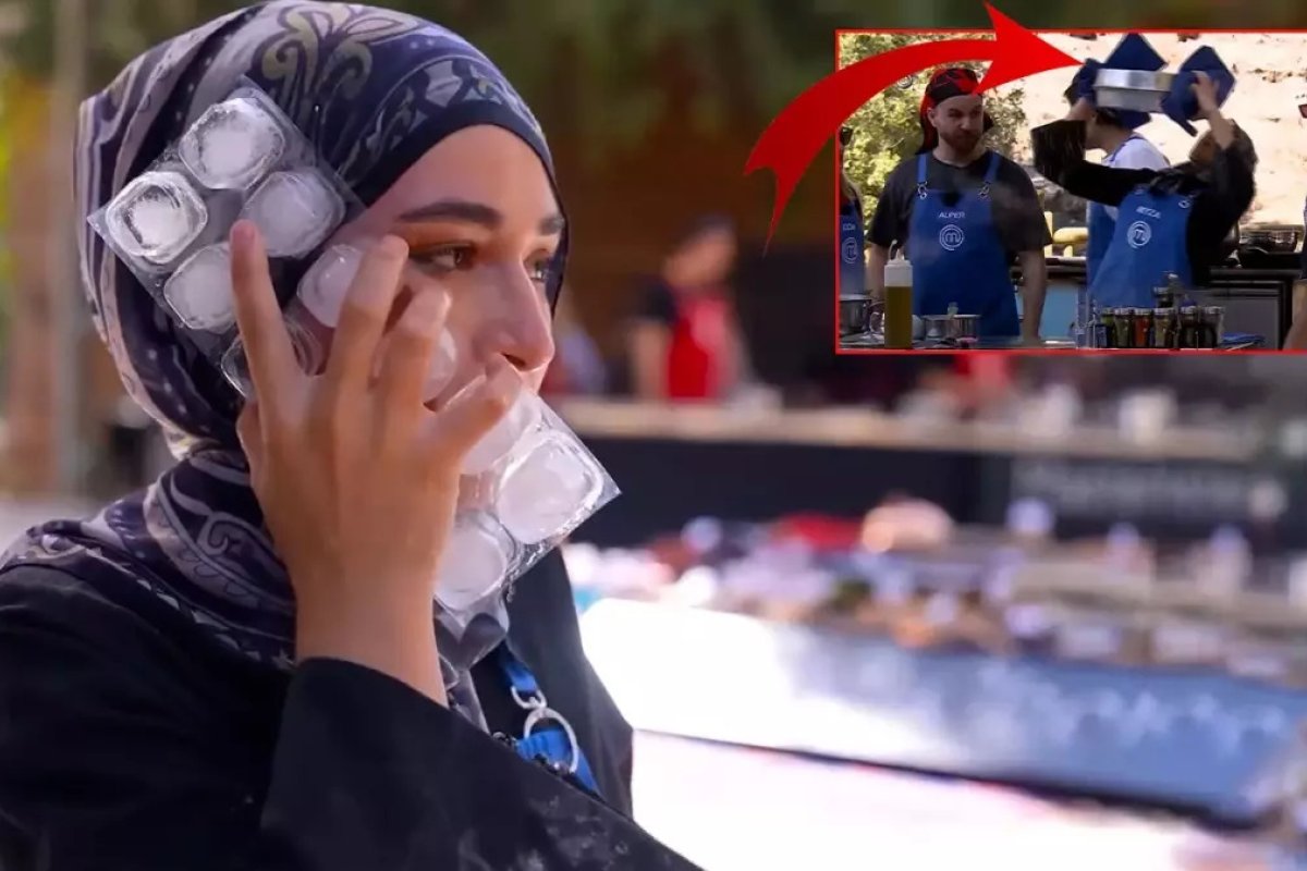 MasterChef yarışmacısının yüzüne kızgın yağ döküldü!